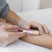 Blood test near Vasna Road - Curepath Diagnostics Laboratory